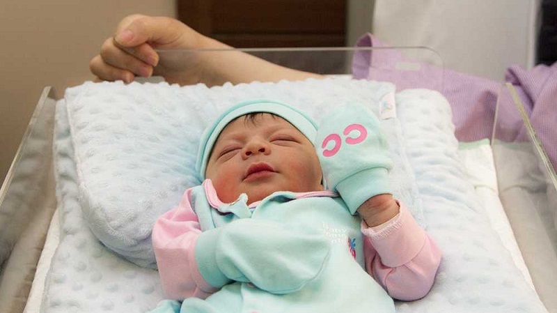 اجاره دستگاه زردی